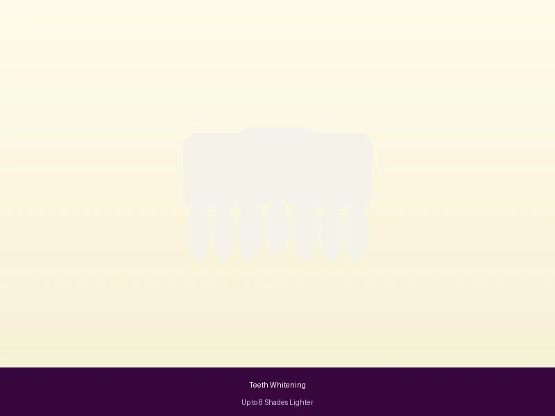 Clinic-Grade Whitening vs <em width=